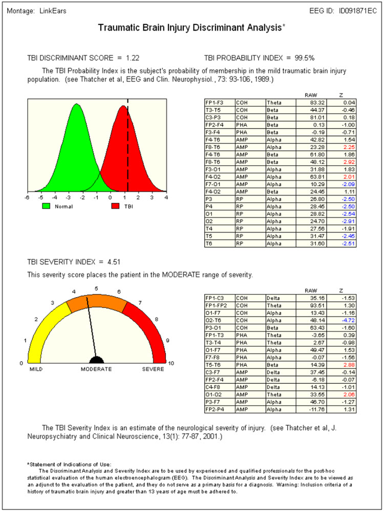 Traumatic brain injury discriminant analysis results showing moderate severity